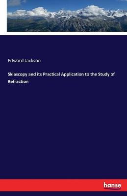 Skiascopy and Its Practical Application to the Study of Refraction