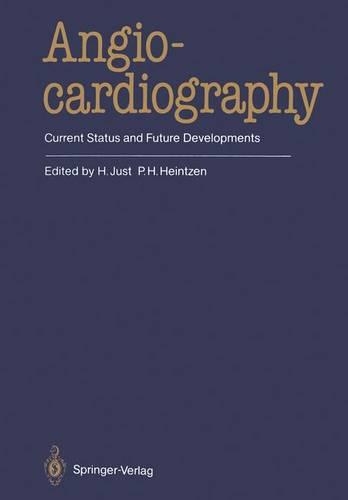 Angiocardiography
