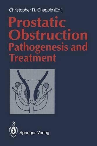 Prostatic Obstruction
