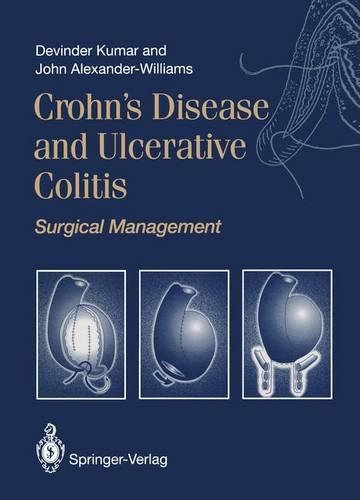 Crohn's Disease and Ulcerative Colitis