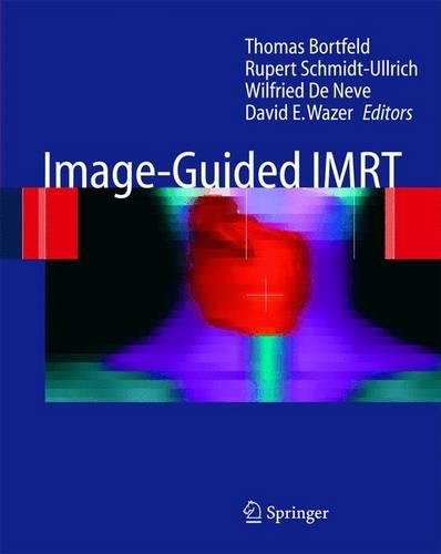 Image Guided IMRT