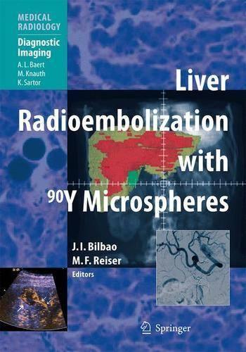 Liver Radioembolization with 90y Microspheres