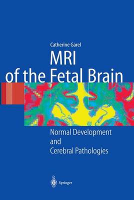 MRI of the Fetal Brain