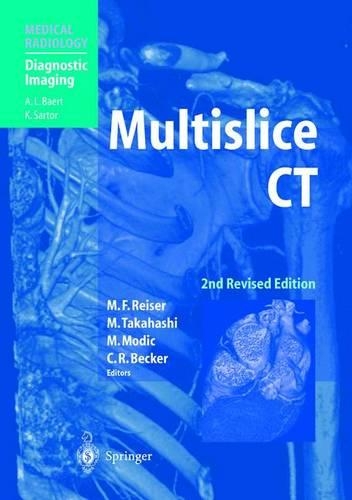 Multislice CT
