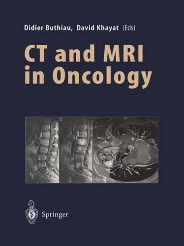 Ct and Mri in Oncology