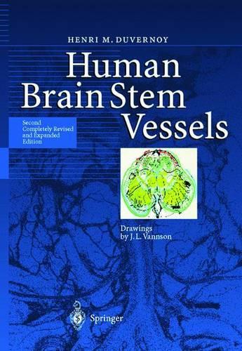 Human Brain Stem Vessels