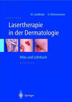 Lasertherapie in Der Dermatologie