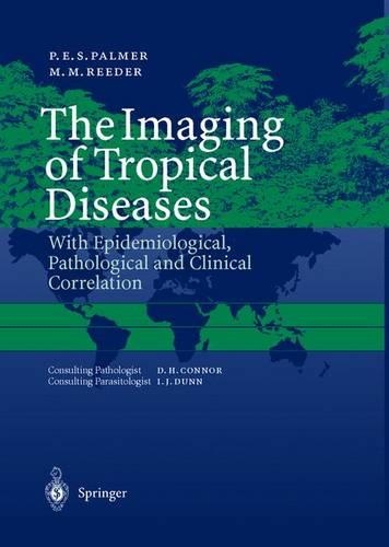The Imaging of Tropical Diseases