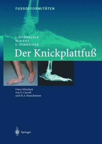 Fussdeformitaten