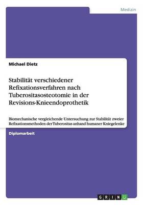 Stabilitat Verschiedener Refixationsverfahren Nach Tuberositasosteotomie in Der Revisions-Knieendoprothetik