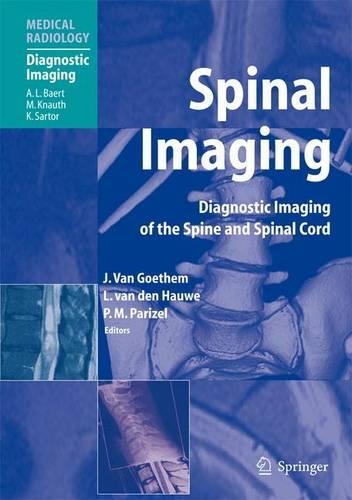 Spinal Imaging