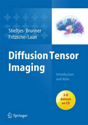 Diffusion Tensor Imaging