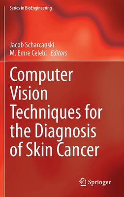 Computer Vision Techniques for the Diagnosis of Skin Cancer