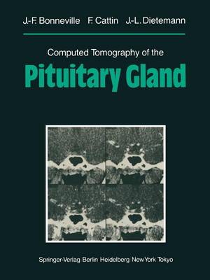 Computed Tomography of the Pituitary Gland