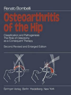 Osteoarthritis of the Hip