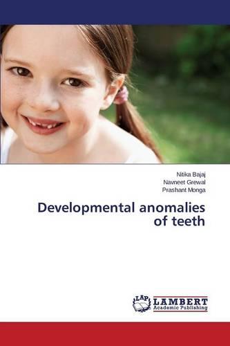 Developmental Anomalies of Teeth