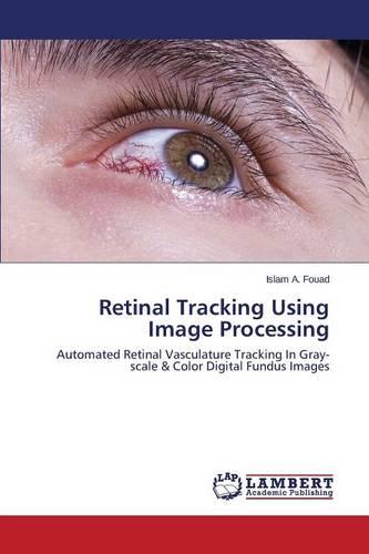 Retinal Tracking Using Image Processing