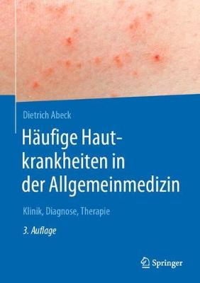 Häufige Hautkrankheiten in der Allgemeinmedizin