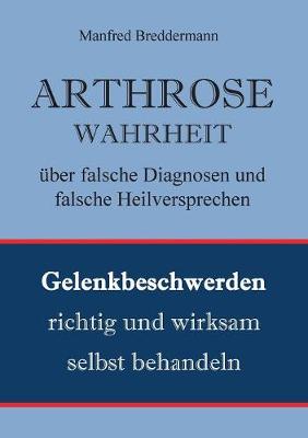 Arthrose