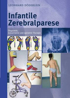 Die Infantilen Zerebralparesen