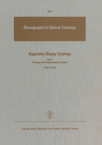 Aspiration Biopsy Cytology