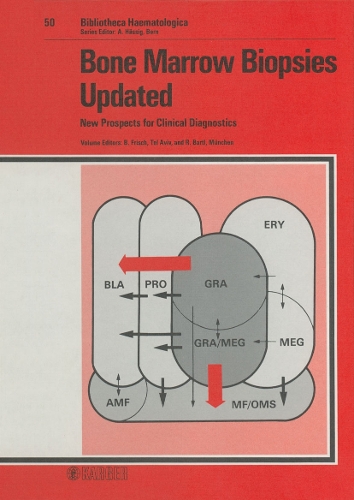 Bone Marrow Biopsies Updated