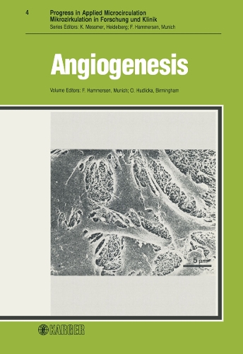 Angiogenesis