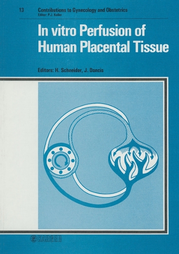 In vitro Perfusion of Human Placental Tissue