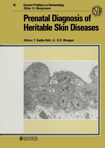 Prenatal Diagnosis of Heritable Skin Diseases
