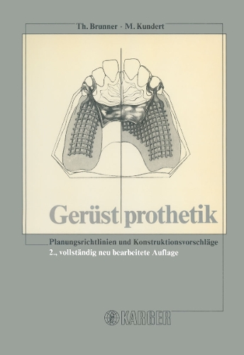Gerüstprothetik