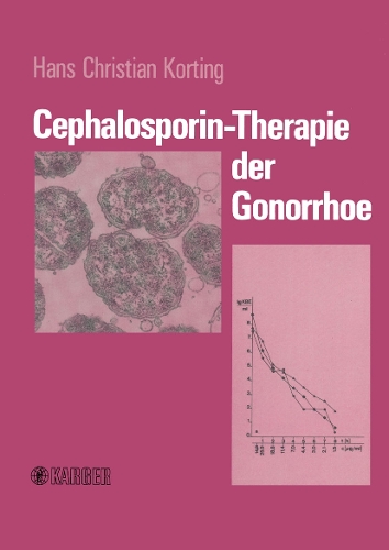 Cephalosporin-Therapie der Gonorrhoe