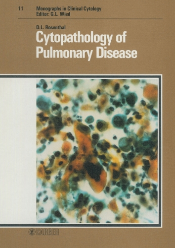 Cytopathology of Pulmonary Disease