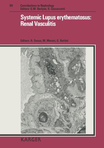Systemic Lupus erythematosus: Renal Vasculitis