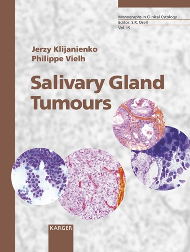 Salivary Gland Tumours