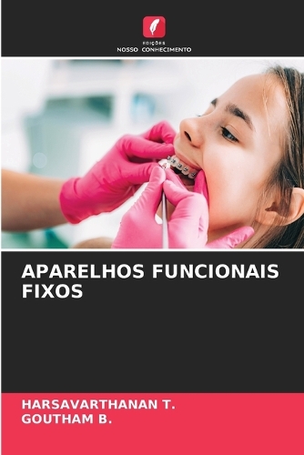 Aparelhos Funcionais Fixos