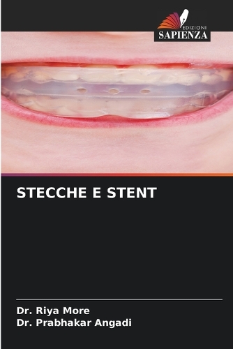 Stecche E Stent