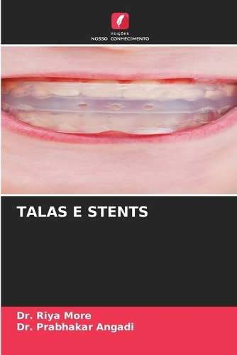 Talas E Stents