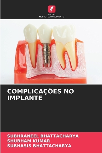 Complicações No Implante