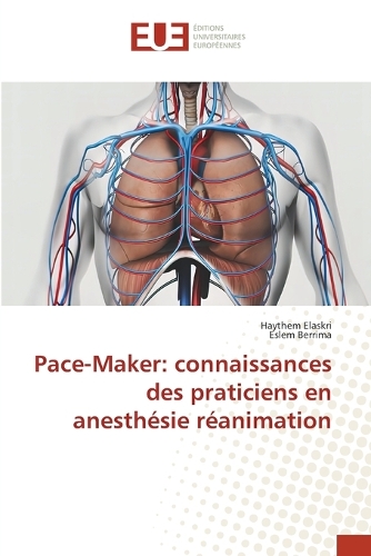 Pace-Maker