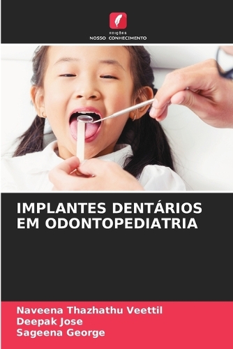 Implantes Dentários Em Odontopediatria