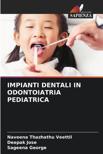 Impianti Dentali in Odontoiatria Pediatrica