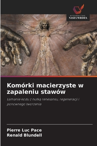 Komórki macierzyste w zapaleniu stawów