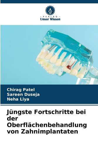 Jüngste Fortschritte bei der Oberflächenbehandlung von Zahnimplantaten