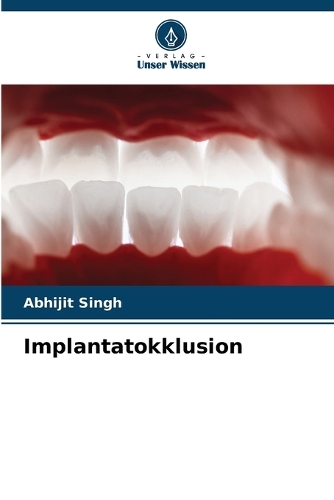 Implantatokklusion