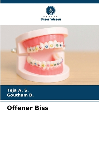 Offener Biss