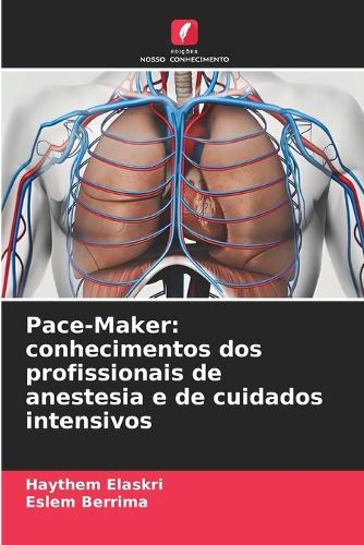 Pace-Maker