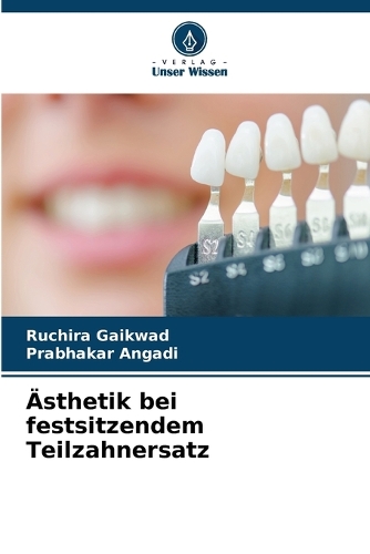 Ästhetik bei festsitzendem Teilzahnersatz
