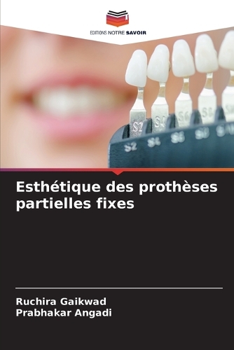 Esthétique des prothèses partielles fixes