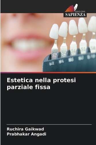 Estetica nella protesi parziale fissa