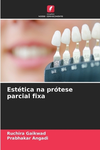 Estética na prótese parcial fixa